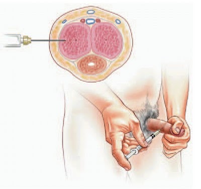 How does testosterone affect the body